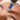 What is dermapen microneedling and what it helps with?